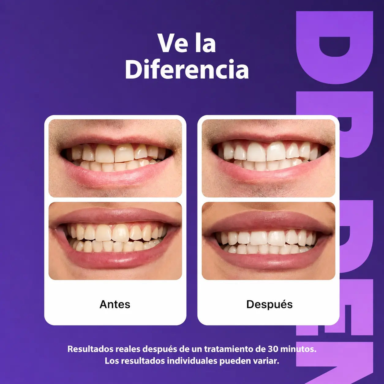 Tiras Blanqueadoras DR DENT© ¡Compra 21 y te regalamos 21 Extra!