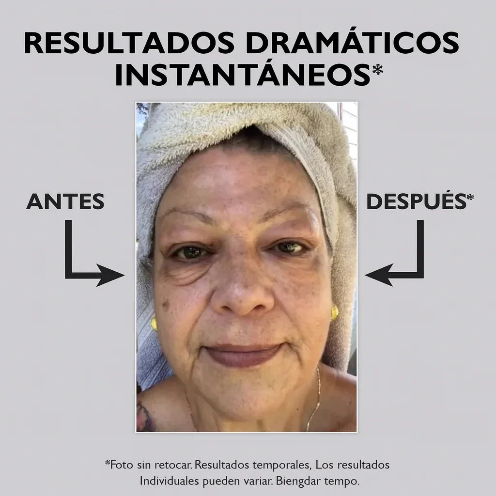 FirmX by PeterThomaSRoth® |Gel Tensor Rejuvenecedor|